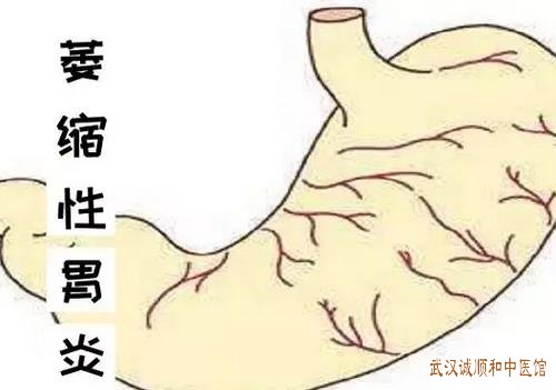 4-22061Q64935621