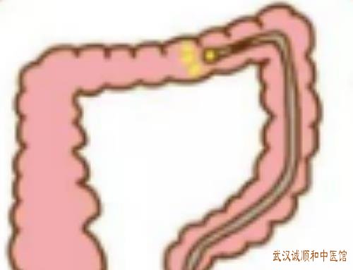 5-230424152241O1